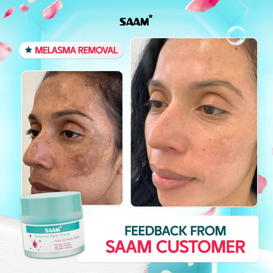 SAAM Renewal Face Cream Melasma, Freckles, Age Spots &amp; Dark Spots With Alpha Arbutin and Kojic Acid