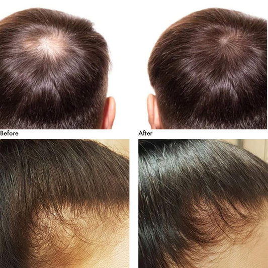 DEXE Fiber Powder 22g: Hair Building Fibers for Fuller Hair, Ideal for Men and Women
